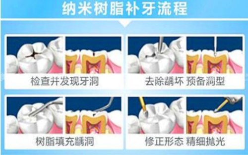 成都牙科哪家好-天府新区补牙诊所-天府新区成都片区